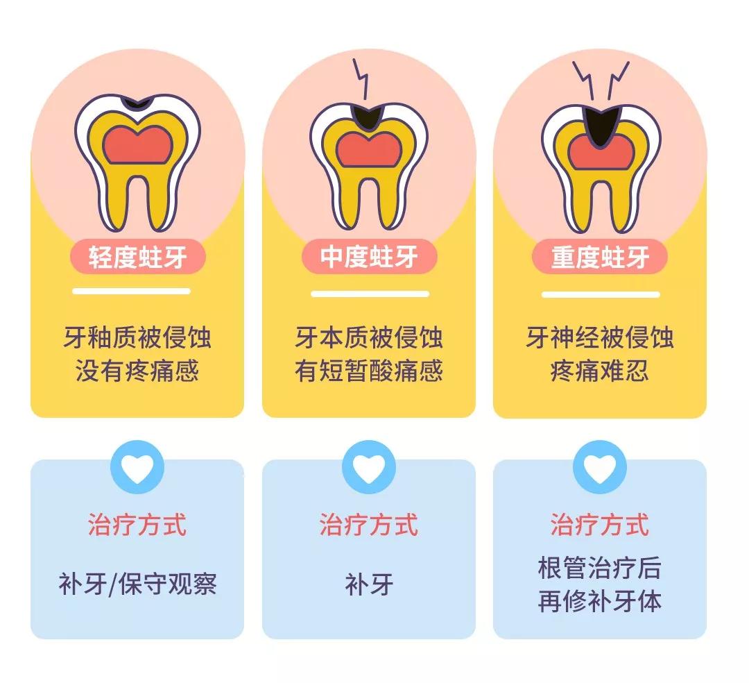 2,蛀牙发展到象牙质部位